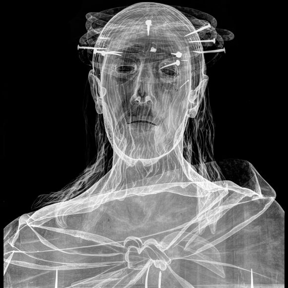 Estudio radiográfico comparativo de Pedro de Mena