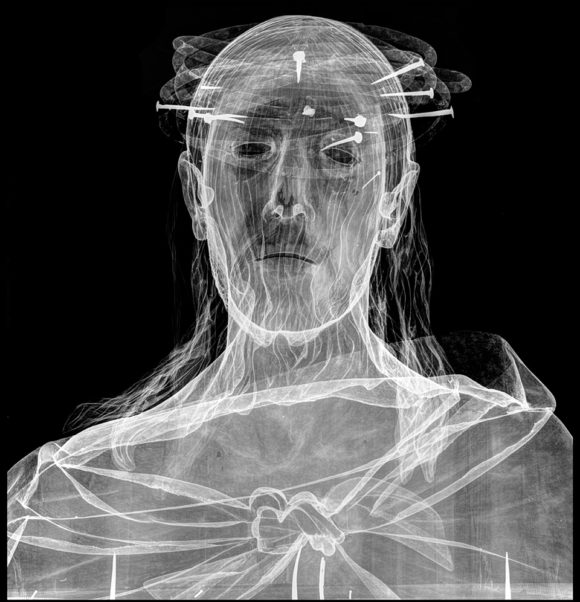 Estudio radiográfico comparativo de Pedro de Mena